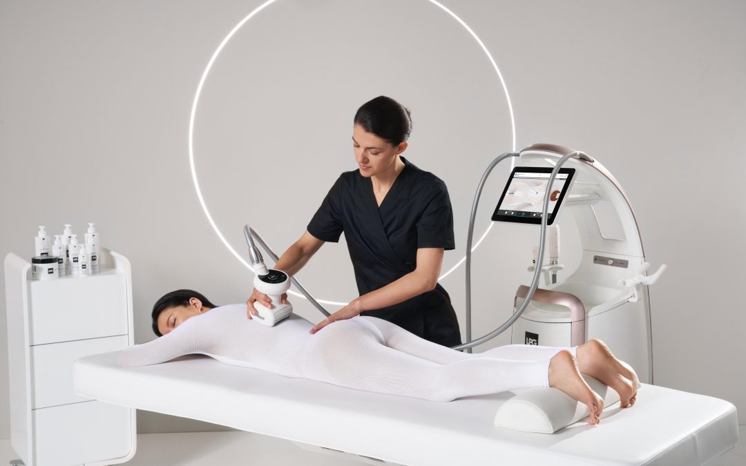 LPG Alliance vs LPG Infinity: Which One Is Right for You?